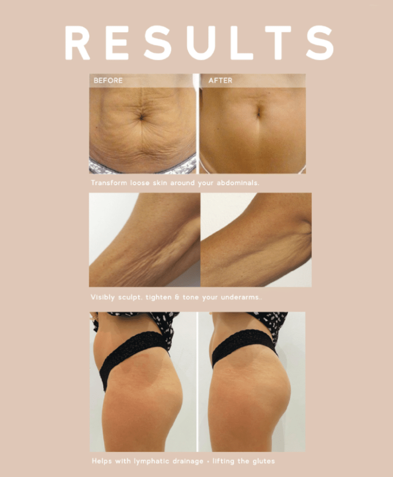 Silhouette Skin Toner + Deep Muscle Massager