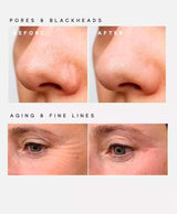 Microdermabrasion Exfoliating Heads